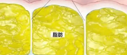 Bioglutide NA-931 Improvements | Shaanxi BLOOM Tech Co., Ltd Bioglutide NA-931 Improvements | Shaanxi BLOOM Tech Co., Ltd